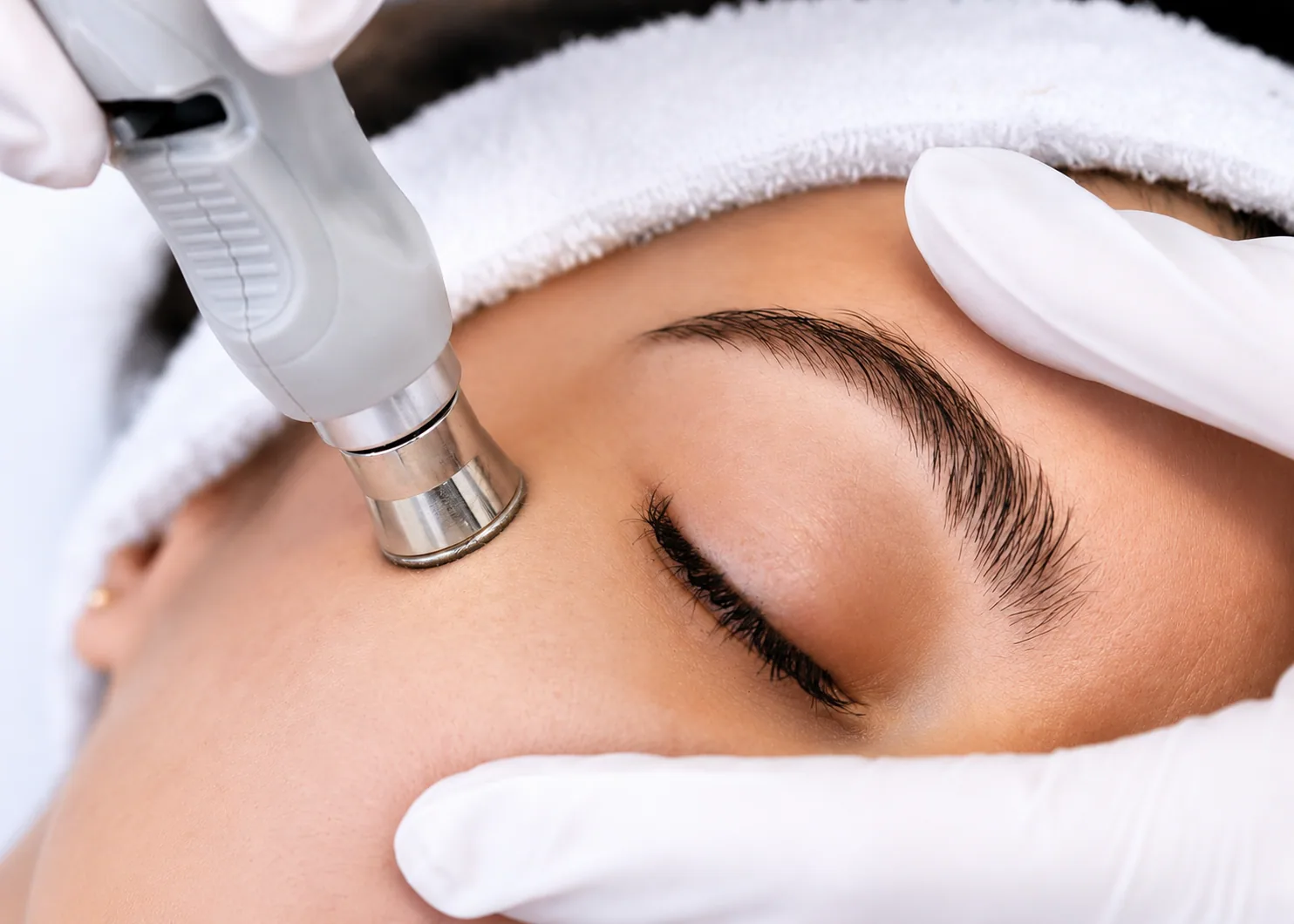 Skin Tightening