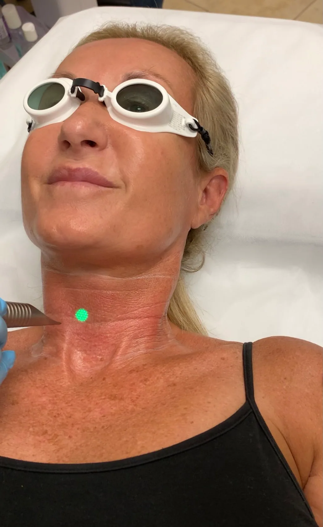 Advanced Laser Vein Solutions